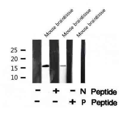 4E- BP1 (Phospho- Thr36) Antibody - Click Image to Close